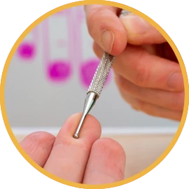 Neka od stanja u kojima je akupunktura efikasna